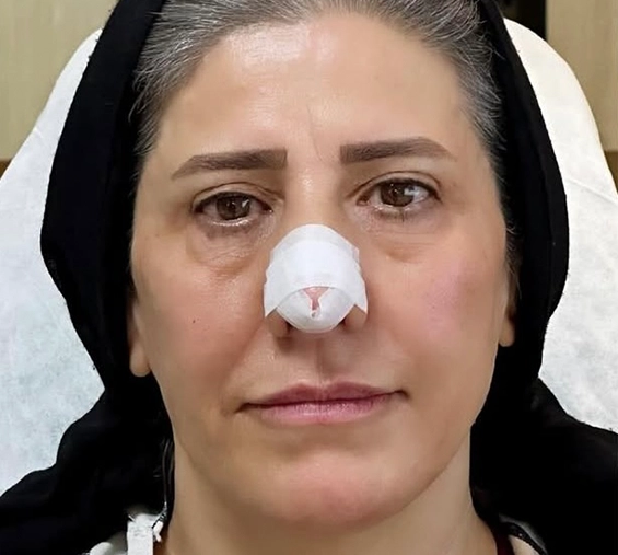 بعد
