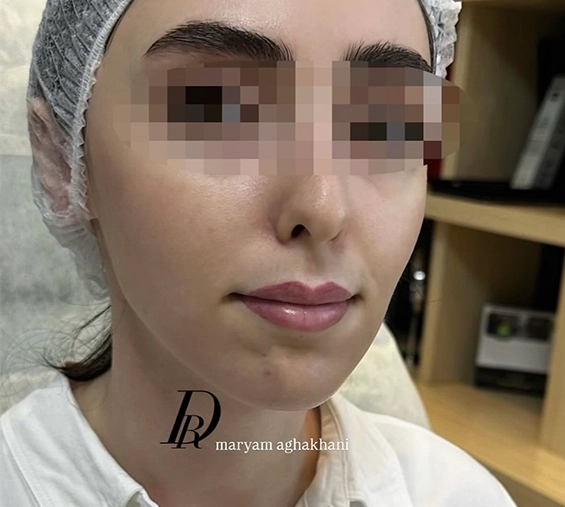 قبل