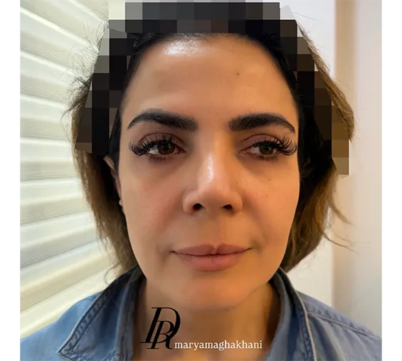 قبل