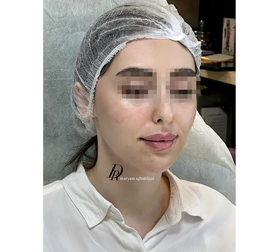 قبل