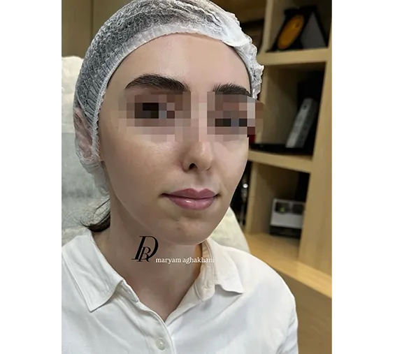 بعد
