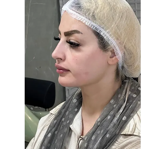 بعد