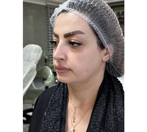 قبل