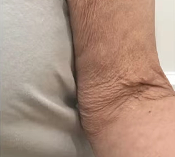قبل
