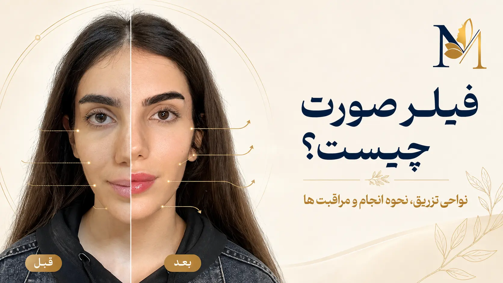 فیلر صورت چیست؟ انواع نواحی تزریق، مزایا و نحوه انجام