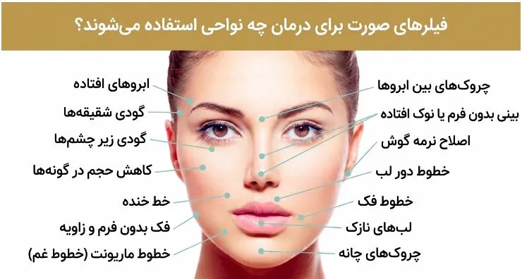  فیلر صورت چگونه انجام میشود