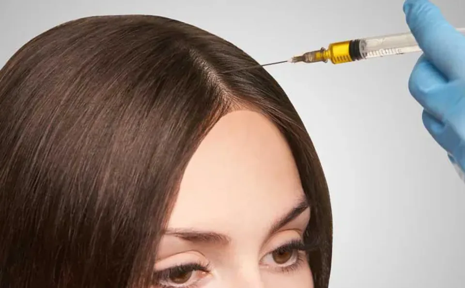 مزوتراپی مو در تبریز